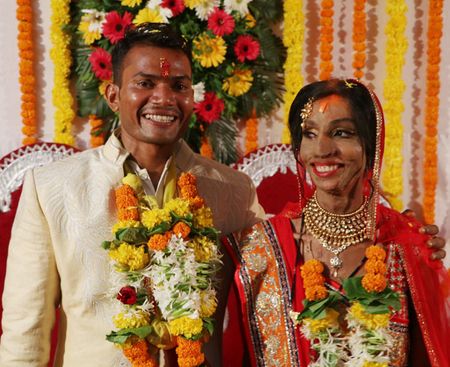 A Fairytale Wedding for an Acid Attack Survivor Who Has the Sweetest Love Story!